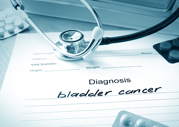 How to Diagnose Bladder Cancer