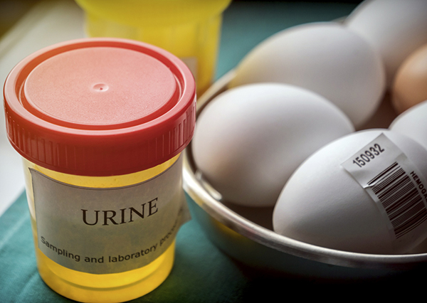 How to Reduce Protein in Urine